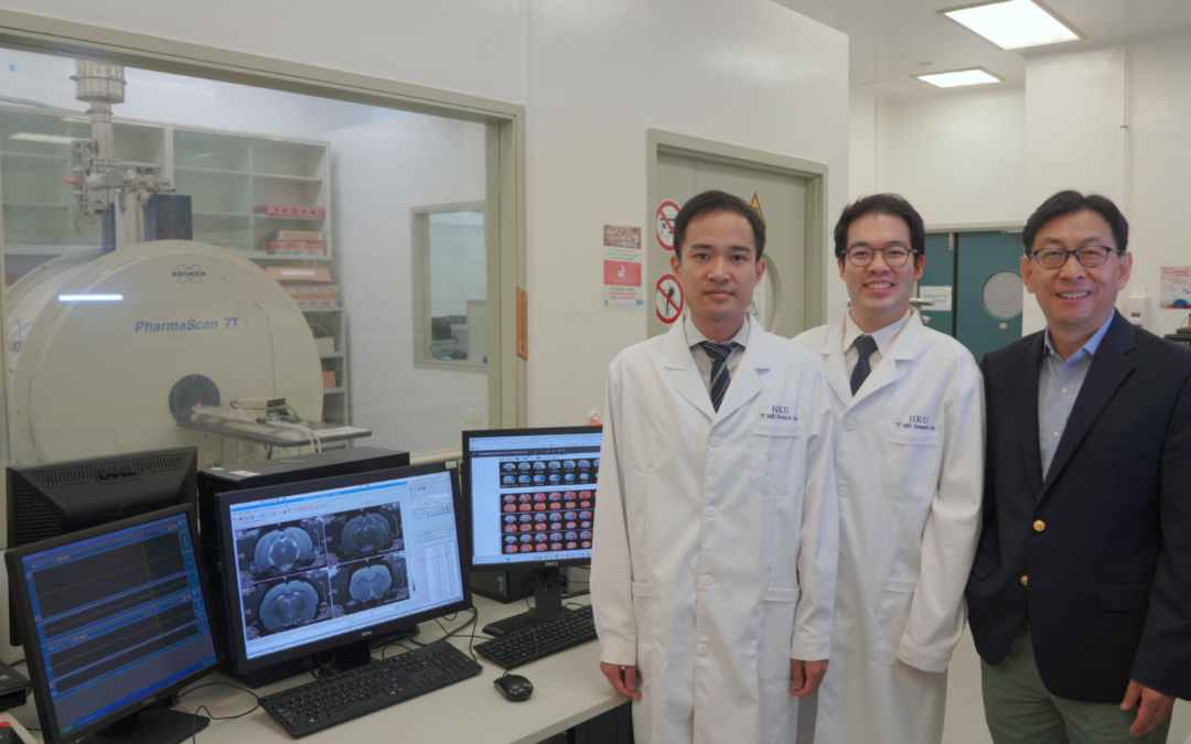 HKU Biomedical Engineering team untangles the brain memory mystery through imaging