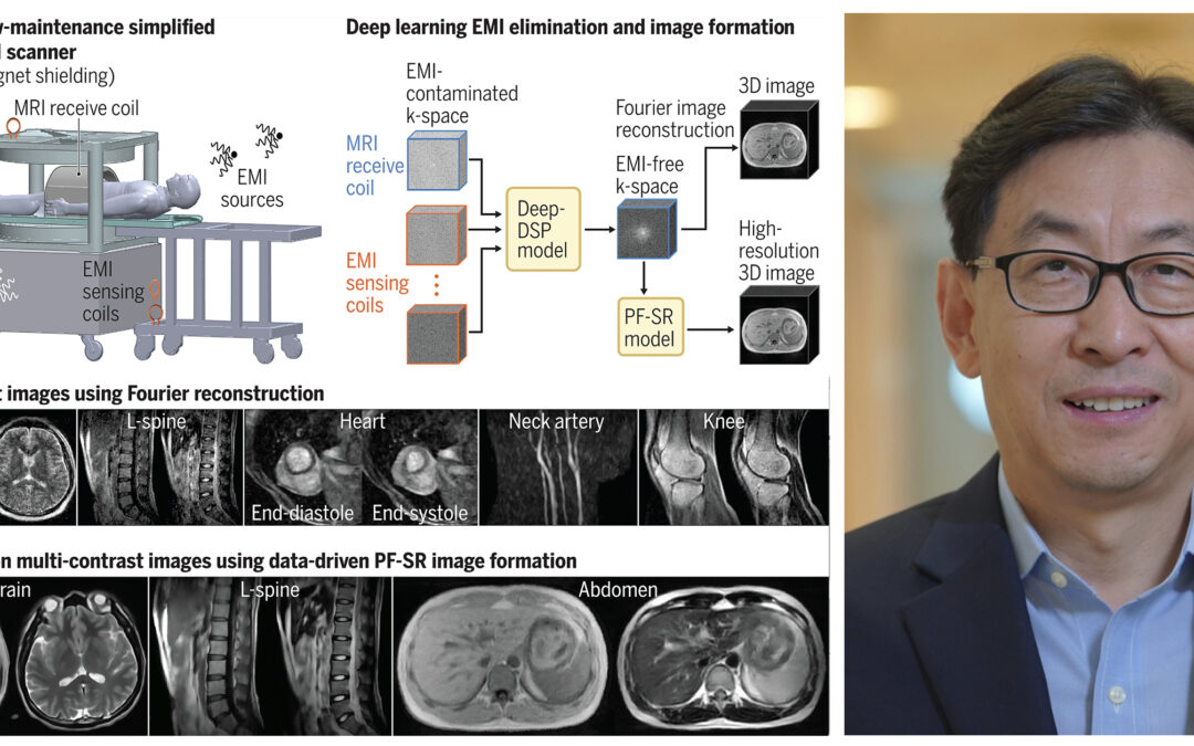 Breakthrough in 0.05 Tesla MRI reported by HKU Engineering team in Science Journal