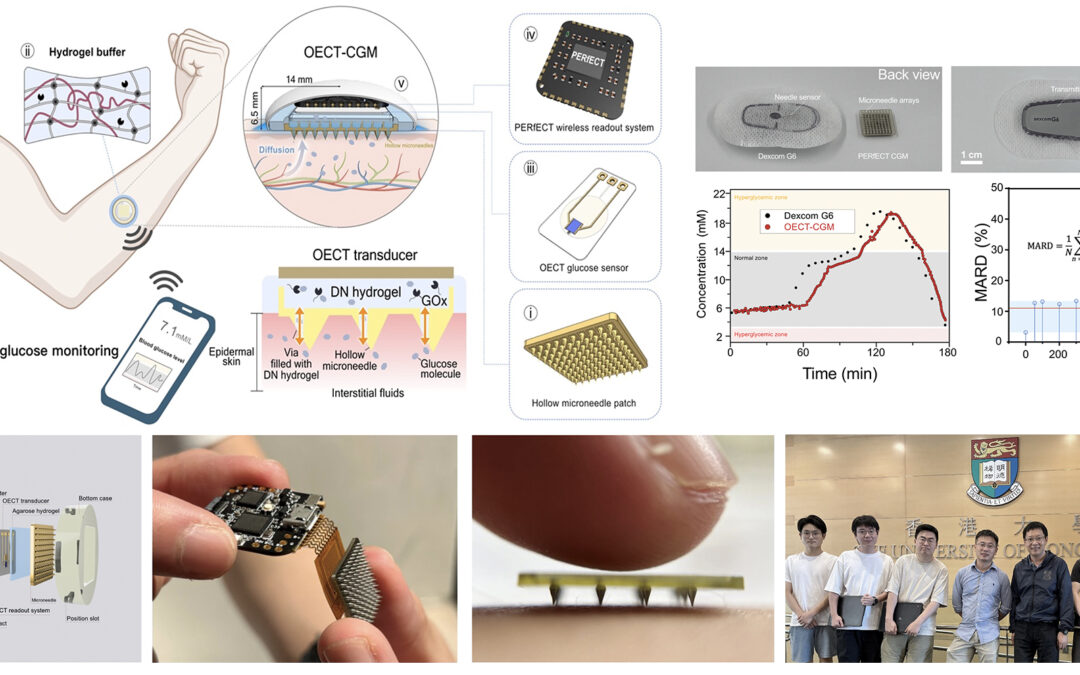 HKU Engineering Team Develops Next-generation Wearable Continuous Glucose Monitoring System for Diabetes Management